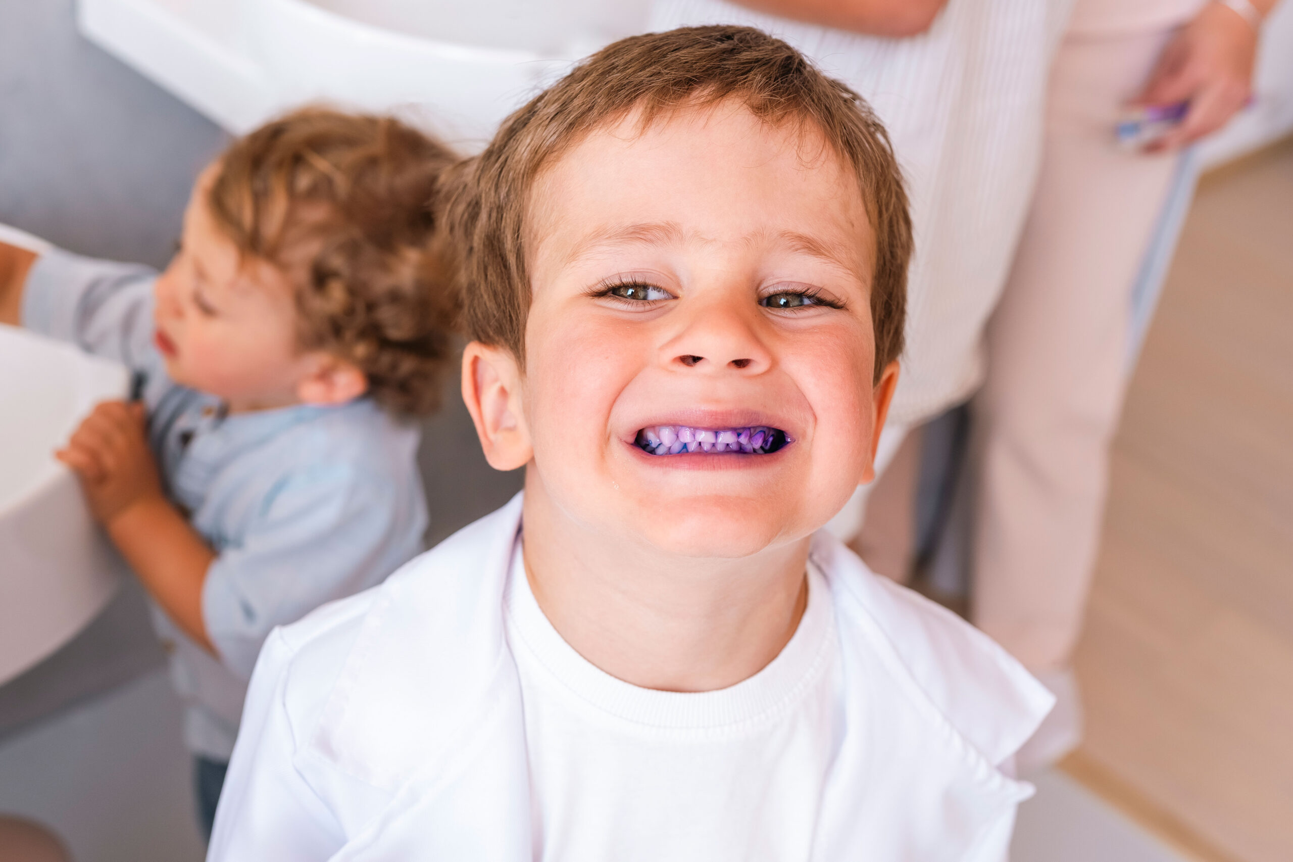 Child with plaque stained by dental disclosing tablet